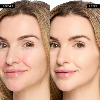 Blemish-Free Undereye Corrector | Buy 1 Get 2 FREE